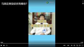 马蹄足典型症状有哪些？