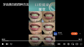牙齿美白的四种方法